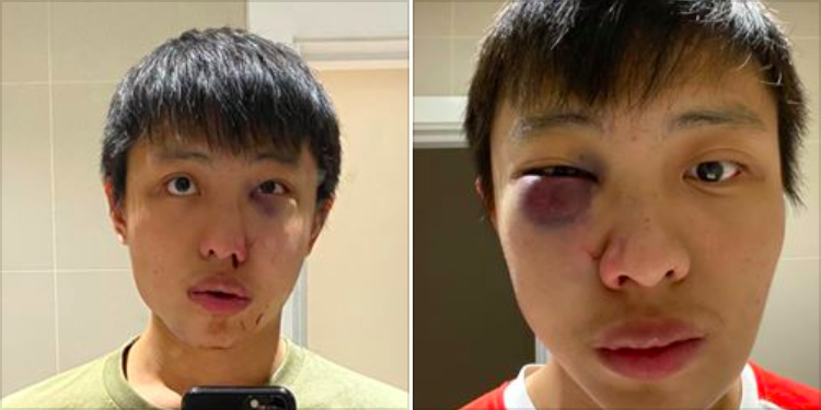 singaporean allegedly attacked in london after racia